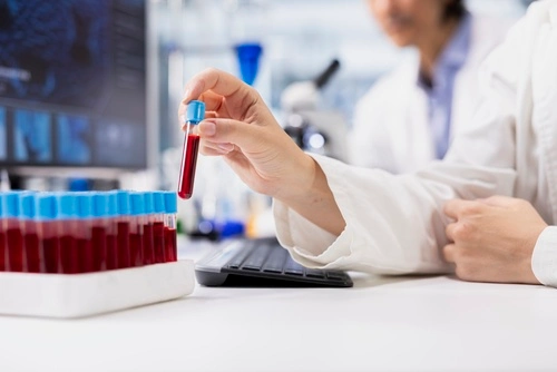 A lab testing tech looks at a blood sample to run diagnostics.
