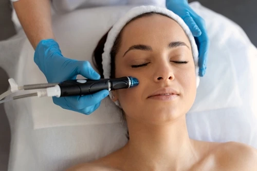A woman has a microdermabrasion facial in Greenville, SC.